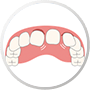 Zahnverletzungen